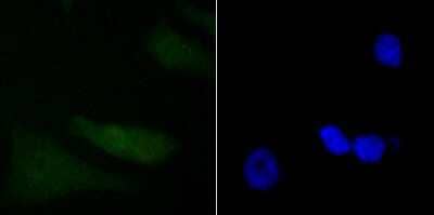 Immunocytochemistry/Immunofluorescence: PDCD4 Antibody (JA80-83) [NBP2-67024] - Staining PDCD4 in PC-3M cells (green). The nuclear counter stain is DAPI (blue). Cells were fixed in paraformaldehyde, permeabilised with 0.25% Triton X100/PBS.