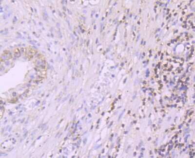 Immunohistochemistry-Paraffin: PDCD4 Antibody (JA80-83) [NBP2-67024] - Analysis of paraffin-embedded human prostate tissue using anti-PDCD4 antibody. Counter stained with hematoxylin.