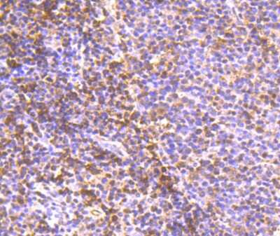 Immunohistochemistry-Paraffin: PDCD4 Antibody (JA80-83) [NBP2-67024] - Analysis of paraffin-embedded human tonsil tissue using anti-PDCD4 antibody. Counter stained with hematoxylin.