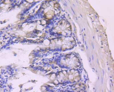 Immunohistochemistry-Paraffin: PDCD4 Antibody (JA80-83) [NBP2-67024] - Analysis of paraffin-embedded mouse colon tissue using anti-PDCD4 antibody. Counter stained with hematoxylin.