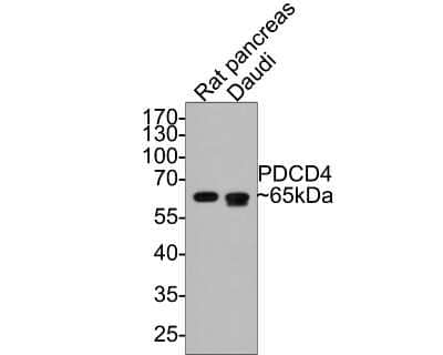 Western Blot: PDCD4 Antibody (JA80-83) [NBP2-67024] - Analysis of PDCD4 on different lysates with Rabbit anti-PDCD4 antibody at 1/500 dilution. Lane 1: Rat pancreas tissue lysate (20 ug/Lane) Lane 2: Daudi cell lysate (10 ug/Lane) Predicted band size: 52 kDa Observed band size: 65 kDaExposure time: 1 minute;10% SDS-PAGE gel.Proteins were transferred to a PVDF membrane and blocked with 5% NFDM/TBST for 1 hour at room temperature. The primary antibody (ET1704-70) at 1/500 dilution was used in 5% NFDM/TBST at room temperature for 2 hours. Goat Anti-Rabbit IgG - HRP Secondary Antibody (HA1001) at 1:300,000 dilution was used for 1 hour at room temperature.
