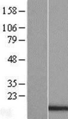 Western Blot: PDCD5 Overexpression Lysate (Adult Normal) [NBL1-14208] Left-Empty vector transfected control cell lysate (HEK293 cell lysate); Right -Over-expression Lysate for PDCD5.