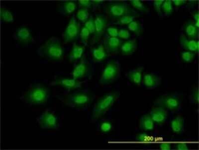 Immunocytochemistry/Immunofluorescence: PDCD6 Antibody (2B4) [H00010016-M01] - Analysis of monoclonal antibody to PDCD6 on HeLa cell. Antibody concentration 10 ug/ml.