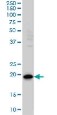 Western Blot PDCD6 Antibody (2B4)