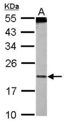 Western Blot: PDCD6 Antibody [NBP2-19741] - Sample (30 ug of whole cell lysate) A: HeLa nucleus 12% SDS PAGE gel, diluted at 1:500.