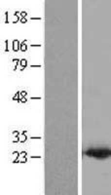 Western Blot PDCD6 Overexpression Lysate