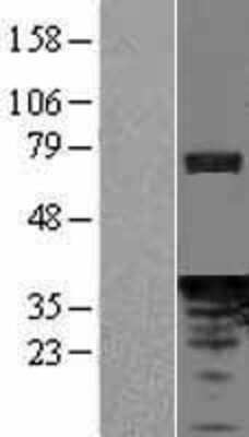 Western Blot PDCL Overexpression Lysate