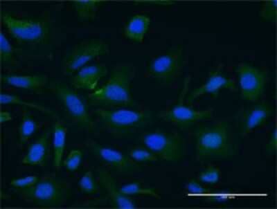 Immunocytochemistry/Immunofluorescence: PDCL3 Antibody (2D7) [H00079031-M02] - Analysis of monoclonal antibody to PDCL3 on HeLa cell . Antibody concentration 10 ug/ml.