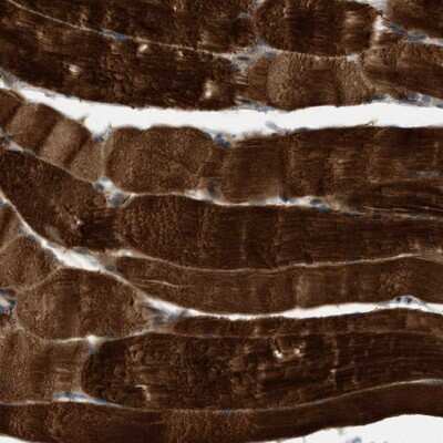 Immunohistochemistry-Paraffin: PDCL3 Antibody [NBP1-80627] - Staining of human skeletal muscle shows strong cytoplasmic positivity in myocytes.