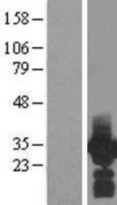 Western Blot PDCL3 Overexpression Lysate