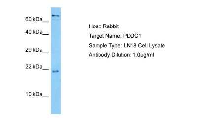 Western Blot: PDDC1 Antibody [NBP2-83374] - Host: Rabbit. Target Name: PDDC1. Sample Tissue: Human LN18 Whole Cell lysates. Antibody Dilution: 1ug/ml