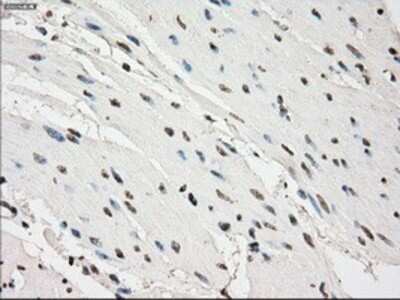 Immunohistochemistry-Paraffin: PDE10A Antibody (1C9) [NBP1-47909] - Staining of paraffin-embedded bladder tissue using anti-PDE10Amouse monoclonal antibody.