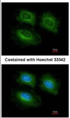 Immunocytochemistry/Immunofluorescence: PDE10A Antibody [NBP2-19742] - Immunofluorescence analysis of methanol-fixed HeLa, using antibody at 1:200 dilution.