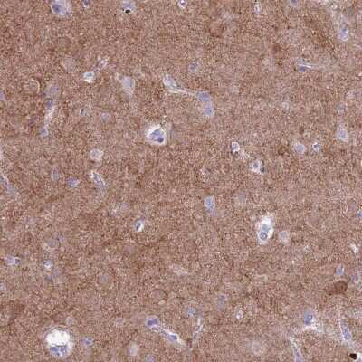 Immunohistochemistry-Paraffin: PDE10A Antibody [NBP2-48869] - Staining of human lateral ventricle shows moderate positivity in neuropil.