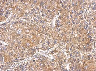 Immunohistochemistry-Paraffin: PDE10A Antibody [NBP2-19742] -  Cal27 xenograft, using PDE10A antibody at 1:500 dilution. Antigen Retrieval: Trilogy™ (EDTA based, pH 8.0) buffer, 15min. 