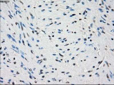 Immunohistochemistry: PDE10A Antibody (OTI1C9) - Azide and BSA Free [NBP2-73273] - Staining of paraffin-embedded prostate tissue using anti-PDE10A mouse monoclonal antibody.