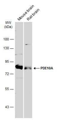 Western Blot: PDE10A Antibody [NBP2-19742] - Various tissue extracts (50 ug) were separated by 7.5% SDS-PAGE, and the membrane was blotted with PDE10A antibody diluted at 1:3000. HRP-conjugated anti-rabbit IgG antibody was used to detect the primary antibody.