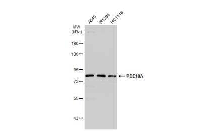 Western Blot: PDE10A Antibody [NBP2-19742] - Various whole cell extracts (30 ug) were separated by 7.5% SDS-PAGE, and the membrane was blotted with PDE10A antibody diluted at 1:1000. HRP-conjugated anti-rabbit IgG antibody was used to detect the primary antibody.