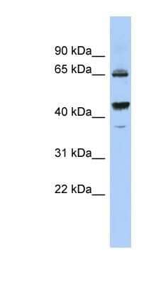Western Blot: PDE12 Antibody [NBP1-70672] - OVCAR-3 cell lysate, concentration 0.2-1 ug/ml.
