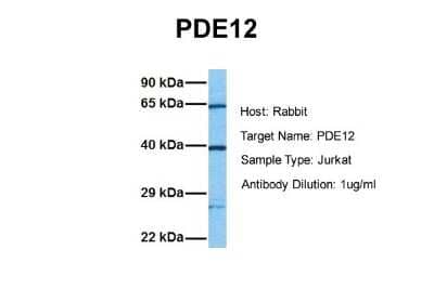 Western Blot: PDE12 Antibody [NBP1-70672] - Sample Tissue: Human Jurkat Antibody Dilution: 1.0 ug/ml