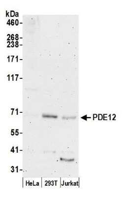 Western Blot: PDE12 Antibody [NBP2-59120] - Detection of human PDE12 by western blot. Samples: Whole cell lysate (50 ug) from HeLa, 293T, and Jurkat cells prepared using NETN lysis buffer. Antibody: Affinity purified rabbit anti-PDE12 antibody NBP2-59120 used for WB at 1:1000. Detection: Chemiluminescence with an exposure time of 3 minutes.