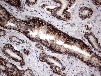 Immunohistochemistry: PDE1A Antibody (7D5) [NBP2-46355] - Analysis of Human prostate tissue. (Heat-induced epitope retrieval by 1 mM EDTA in 10mM Tris, pH8.5, 120C for 3min)