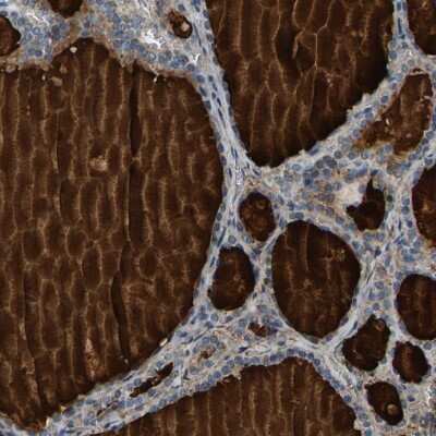 Immunohistochemistry-Paraffin: PDE1A Antibody [NBP1-86009] - Staining of human thyroid gland shows colloid positivity in glandular cells.