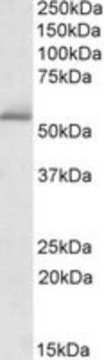 Western Blot: PDE1A Antibody [NBP1-51996] - Western blot analysis of PDE1A in Human Cerebellum lysate (35ug protein in RIPA buffer) using NBP1-51996 at 1ug/ml. Primary incubation was 1 hour. Detected by chemiluminescence.