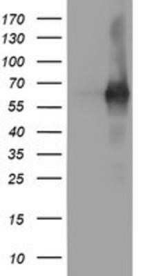 Western Blot: PDE1B Antibody (OTI6E4) - Azide and BSA Free [NBP2-73278] - HEK293T cells were transfected with the pCMV6-ENTRY control (Left lane) or pCMV6-ENTRY PDE1B (Right lane) cDNA for 48 hrs and lysed. Equivalent amounts of cell lysates (5 ug per lane) were separated by SDS-PAGE and immunoblotted with anti-PDE1B.