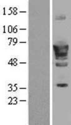 Western Blot: PDE1B Overexpression Lysate (Adult Normal) [NBL1-14215] Left-Empty vector transfected control cell lysate (HEK293 cell lysate); Right -Over-expression Lysate for PDE1B.