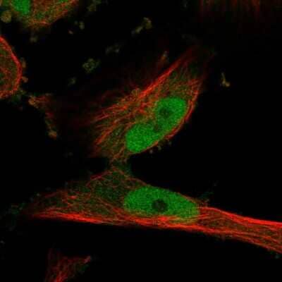 Immunocytochemistry/Immunofluorescence: PDE1C Antibody [NBP2-38666] - Immunofluorescent staining of human cell line U-251 MG shows localization to nucleoplasm.