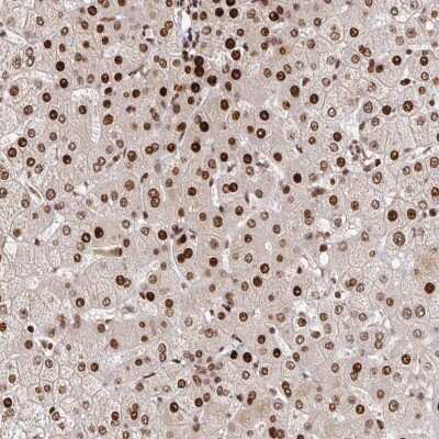 Immunohistochemistry-Paraffin: PDE1C Antibody [NBP2-38666] - Staining of human liver shows strong nuclear positivity in hepatocytes.