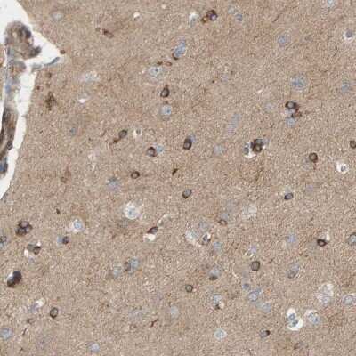 Immunohistochemistry-Paraffin: PDE1C Antibody [NBP2-48555] - Staining of human cerebral cortex shows strong cytoplasmic positivity in glial cells.