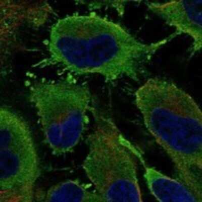 Immunocytochemistry/Immunofluorescence: PDE3A Antibody [NBP3-17664] - Staining of human cell line HeLa shows localization to plasma membrane.