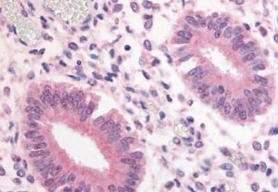 Immunohistochemistry-Paraffin: PDE3A Antibody [NB110-40469] - Analysis of anti-PDE3A antibody with human uterus at 20 ug/ml.