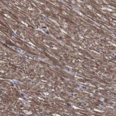 Immunohistochemistry-Paraffin: PDE3A Antibody [NBP3-17664] - Staining of human heart muscle shows strong cytoplasmic positivity in myocytes.