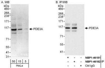 Western Blot: PDE3A Antibody [NBP1-46181] - Whole cell lysate (5, 15 and 50 mcg for WB; 1 mg for IP, 20% of IP loaded) from HeLa cells.  Affinity purified rabbit anti-PDE3A antibody used for WB at 0.04 mcg/ml (A) and 1 mcg/ml (B) and used for IP at 3 mcg/mg lysate.  PDE3A was also immunoprecipitated by rabbit anti-PDE3A antibody NBP1-46182, which recognizes a downstream epitope.