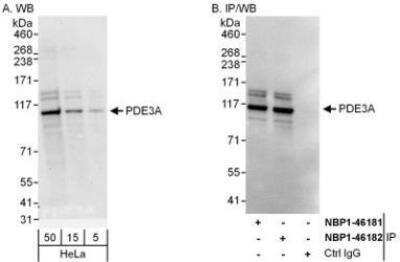 Western Blot: PDE3A Antibody [NBP1-46182] - Whole cell lysate (5, 15 and 50 mcg for WB; 1 mg for IP, 20% of IP loaded) from HeLa cells.  Antibodies: Affinity purified rabbit anti-PDE3A antibody  used for WB at 0.04 mcg/ml (A) and 1 mcg/ml (B) and used for IP at 3 mcg/mg lysate.  PDE3A was also immunoprecipitated by rabbit anti-PDE3A antibody NBP1-46181, which recognizes an upstream epitope.