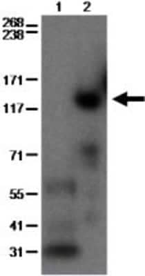 Western Blot: PDE3B Antibody (SMCP3B) [NBP1-43333] - Lysates prepared from mouse heart (lane 1) or lymph node cells (lane 2) were run under reducing conditions on a 3-8% Tris-Acetate gel. The membrane was probed with 2 ug/mL of Anti-Mouse PDE3B Purified, followed by Anti-Rat IgG HRP.