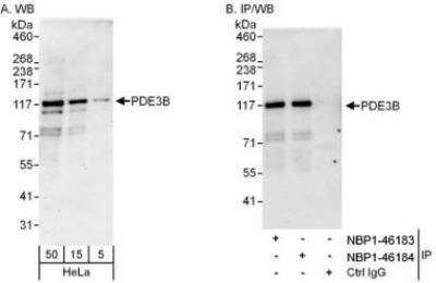 Western Blot: PDE3B Antibody [NBP1-46183] - Detection of Human PDE3B by Western Blot and Immunoprecipitation. Samples: Whole cell lysate (5, 15 and 50 mcg for WB; 1 mg for IP, 20% of IP loaded) from HeLa cells. Antibodies: Affinity purified rabbit anti-PDE3B antibody NBP1-46183  used for WB at 0.1 mcg/ml (A) and 1 mcg/ml (B) and used for IP at 3 mcg/mg lysate. PDE3B was also immunoprecipitated by rabbit anti-PDE3B antibody NBP1-46184, which recognizes a downstream epitope. For blotting immunoprecipitated PDE3B, the blot  Reagents and Procedures were used. Detection: Chemiluminescence with exposure times of 3 minutes (A) and 30 seconds (B).