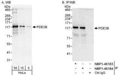 Western Blot: PDE3B Antibody [NBP1-46184] - Detection of Human PDE3B by Western Blot and  Immunoprecipitation. Samples: Whole cell lysate (5, 15 and50 mcg for WB; 1 mg for IP, 20% of IP loaded) from HeLa cells. Antibodies: Affinity purified rabbit anti-PDE3B antibody NBP1-46184 used for WB at 0.04 mcg/ml (A) and 1 mcg/ml (B) and used for IP at 3 mcg/mg lysate. PDE3B was also immunoprecipitated by rabbit anti-PDE3B antibody NBP1-46183, which recognizes an upstream epitope. For blotting immunoprecipitated PDE3B, the blot Reagents and Procedures were used. Detection: Chemiluminescence with exposure times of 30 seconds(A) and 10 seconds (B).