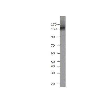 Western Blot PDE3B Antibody