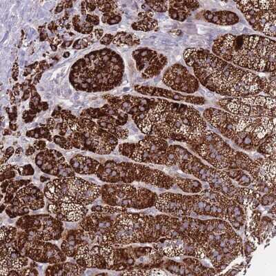 Immunohistochemistry: PDE4A Antibody [NBP2-33388] - Staining of human adrenal gland shows strong cytoplasmic positivity in glandular cells.