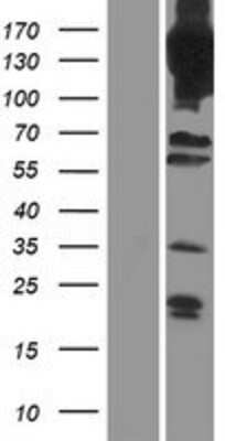 Western Blot: PDE4A Overexpression Lysate (Adult Normal) [NBP2-09382] Left-Empty vector transfected control cell lysate (HEK293 cell lysate); Right -Over-expression Lysate for PDE4A.