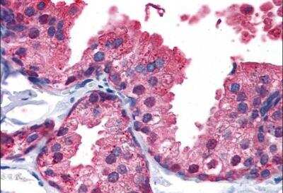 Immunohistochemistry-Paraffin: PDE4B Antibody [NB100-2562] - (5ug/ml) staining of paraffin embedded Human Prostate. Steamed antigen retrieval with citrate buffer pH 6, AP-staining.