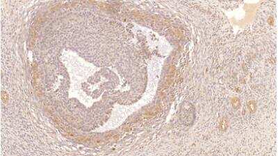 Immunohistochemistry-Paraffin: PDE4B Antibody [NBP3-12243] - IHC of NBP3-12243 with human ovarian medulla tissue. 1:300 antibody dilution.