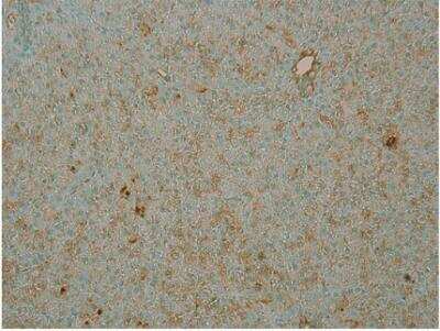 Immunohistochemistry-Paraffin: PDE4B Antibody [NBP3-12243] - IHC of NBP3-12243 and human neuroblastoma cells. 1:250 antibody dilution.