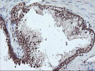 Immunohistochemistry: PDE4B Antibody (OTI1D12) - Azide and BSA Free [NBP2-73292] - Staining of paraffin-embedded Human prostate tissue using anti-PDE4B mouse monoclonal antibody.