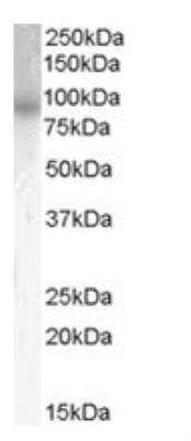 Western Blot: PDE4B Antibody [NB100-2562] - Staining of Mouse Brain Lysate (35ug protein in RIPA buffer). Primary incubation was 1 hour. Detected by chemiluminescence.