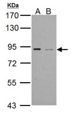 Western Blot: PDE4B Antibody [NBP1-33637] - Sample (30 ug of whole cell lysate) A: NT2D1 B: PC-3 7. 5% SDS PAGE, antibody diluted at 1:1000 .